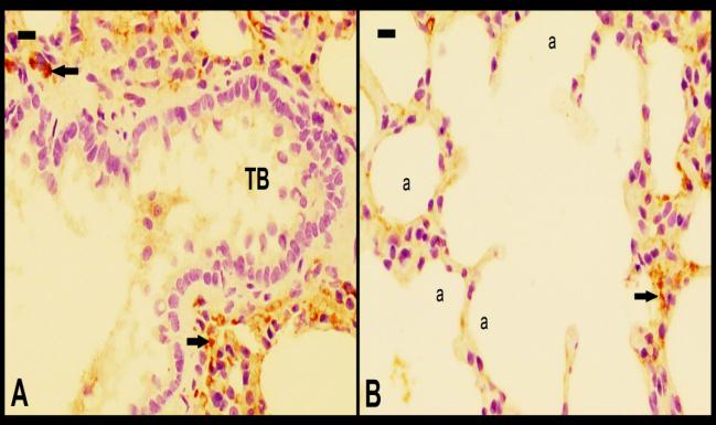 Resim 2. CLP grubuna ait akciğer kesitleri. Bv: kan damarları, a: alveol, TB: terminal bronşiol. Boya; H&E, kesit kalınlığı:5 µm. Ortalama skor: 2,71.