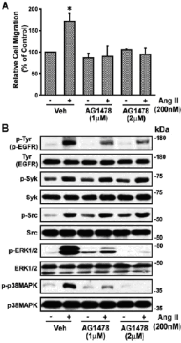 B, SB nin Ang II ile uyarılmış DDK hücrelerinde fosfo (p)-tyr (p-egfr), (p)-dtk, p-src, p-erk1/2 ve p-p38 MAPK protein düzeyleri üzerindeki etkisi. Şekil 6.