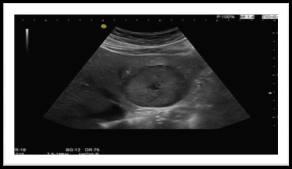 Ultrasonografi (USG): Hasta başında yapılabilme avantajı vardır.