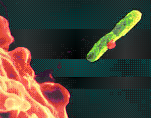 Legionella bakterisi ile mücadelede otelde alınması gereken önlemler