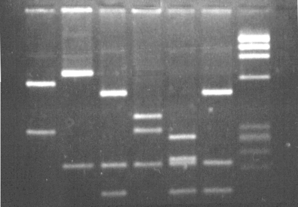 tüpünde saf su Sorular 1) DNA bulunan tüpleri tespit etmek için ne yapmanız gerekir?