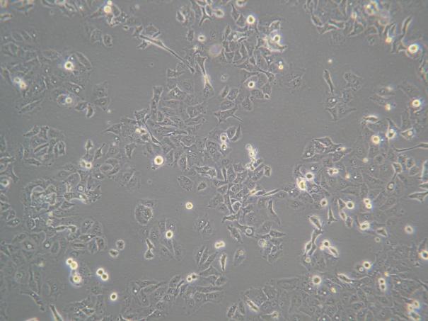 HUVEC (Human Umblical Vein Endothelial Cell) Hücreleri MCF-7 (meme kanseri)