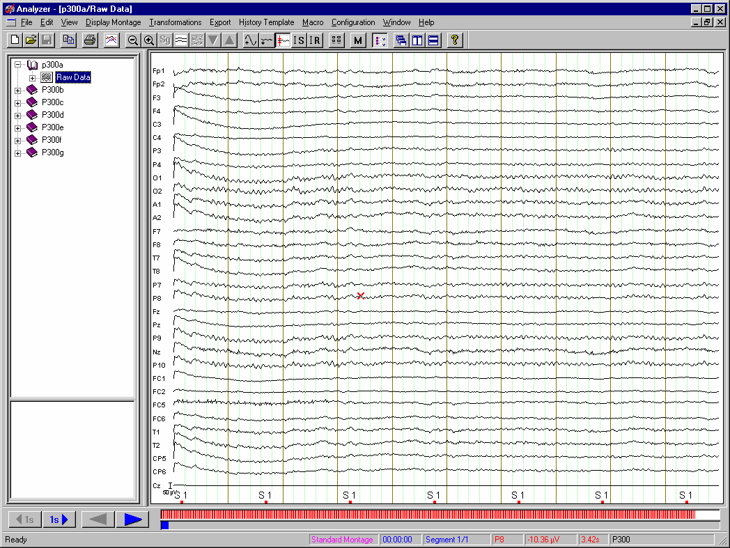 Şu an için kullanılan Vision Analyzer programının iki versiyonu bulunmaktadır.