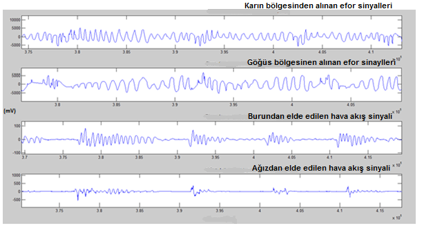 aynı sorunlar günümüze de taşınmıştır [19].