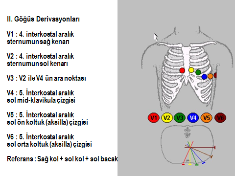 Unipolar Göğüs