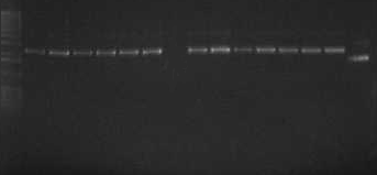 İlknur PORSUK 4.1.4.2. PKS-I Genlerinin Pütatif Ketosentaz Domainlerinin Klonlanması Streptomyces sp.