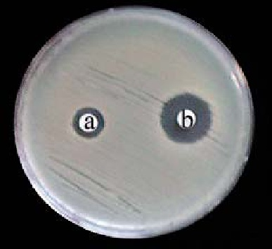 GSBL doğrulama testleri Doğrulama testlerinde GSBL lerin beta-laktamaz inhibitörlerine duyarlı olma özelliğinden faydalanılmaktadır. Sık olarak kullanılan yöntemler şunlardır. 1.