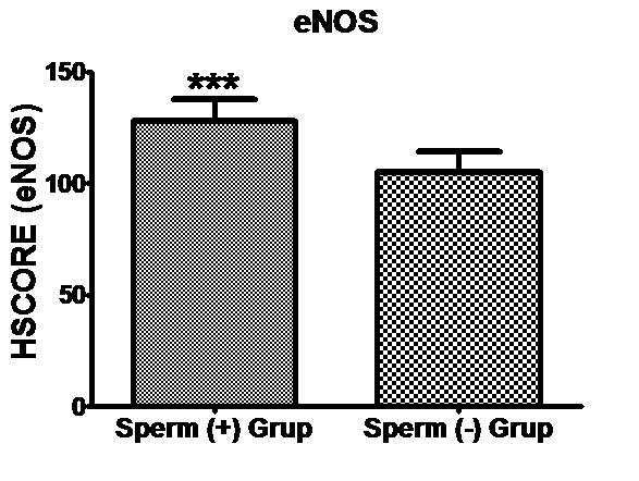 Resim 7: Spermatozoa içermeyen gruba ait testis dokusunda, seminifer tubüllerde