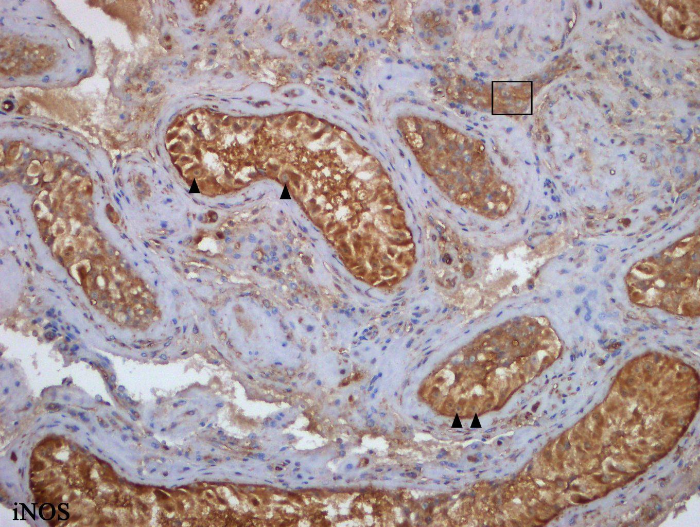 Bar: 50 μm Grafik 3: Spermatozoa içermeyen gruba ait inos immun