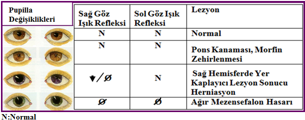 Tablo 1.3: Pupilla değişiklikleri ve ışık reaksiyonları Nörolojik sorunu olan bir hastada pupillaların yanı sıra göz hareketlerinin de değerlendirilmesi gerekir.