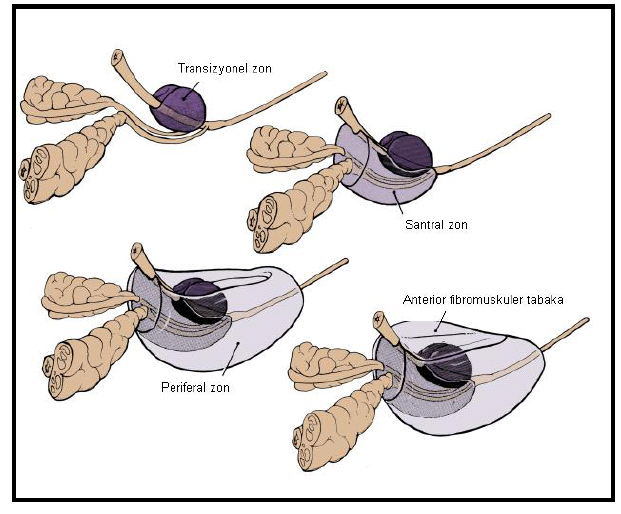 ekil 1. Prostat n bölgesel anatomisi Prostatn glandüler dokusunun % 25 ini olu%turan santral zonun kanallar ejekulatuar açlma bölgesinin çevresinden çepeçevre olarak köken alr.