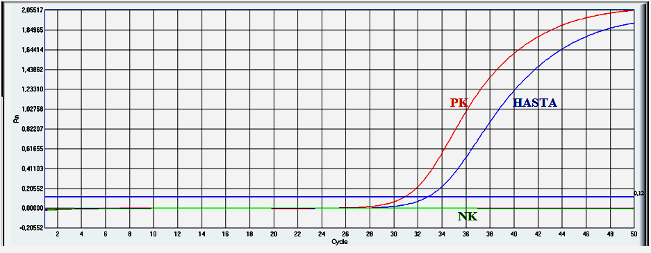 Cilt 69 Sayı 4 2012 TÜBERKÜLOZ SPONDİLODİSKİT hemoglobin 12,8 g/dl, biyokimya değerleri normal, C-reaktif protein 11,4 mg/dl, sedimantasyon 12 mm/s, tam idrar tetkiki normal saptandı.