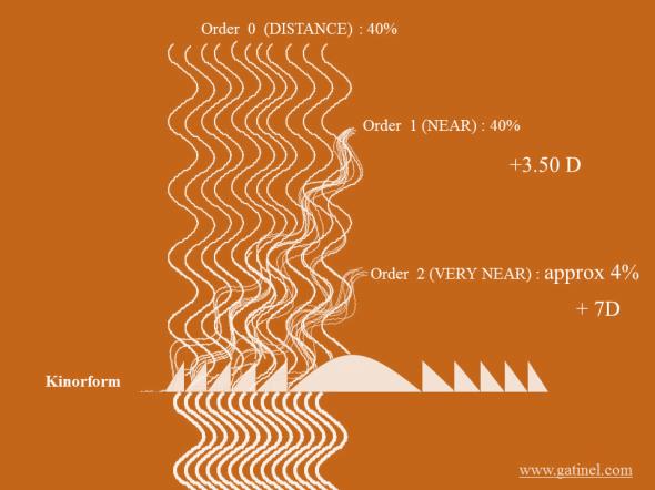 Trifokalite Nasıl Sağlanıyor? %40 0. sıra: (uzak odak) %40 1. sıra: +3.5 D ise (yakın odak) % 4 2. sıra: +7.0 D.