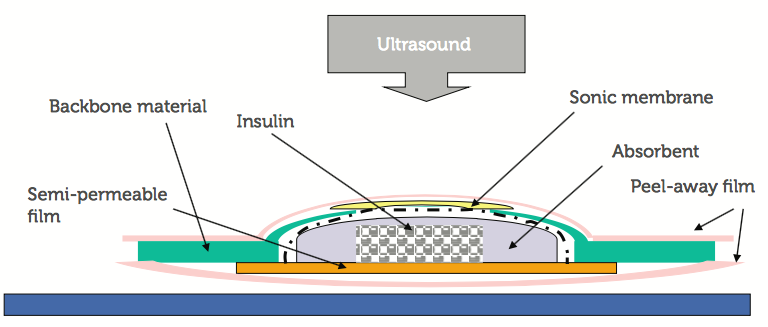 Sonophoresis