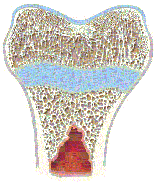 The Chondrocyte: Biological and Clinical Application, Tissue Eng. 2006, 7:1971-84 http://www.