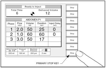 BİR ENJEKSİYONUN SONLANDIRILMASI Bir önceki kısımda görüldüğü gibi, Enjektör Kafası üzerindeki herhangi bir tuş veya Konsol ve Uzaktan Kumanda El Şalteri üzerindeki [Stop] tuşları bir enjeksiyonu
