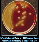 C. difficile -Tanı Selektif Anaerobik Kültür: C.