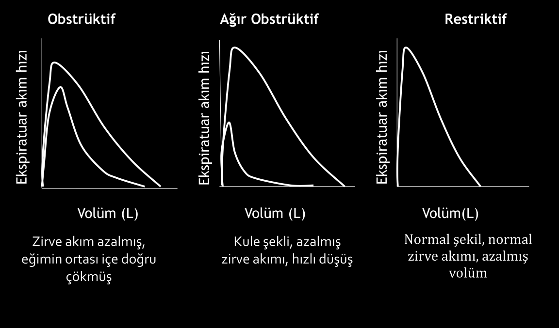 Restriktif hastalıklarda ise RV, FRC ve TLC azalmaktadır, RV/TLC oranı ise genellikle normal kalır (7).