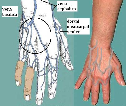 El sırtı venleri V. sefalica ve basilicanın el sırtındaki dalları ile dorsal metakarpal venler kullanılır. Ayak sırtı venleri Ayak üzerinde v. saphena magna ve parvanın dalları kullanılır.