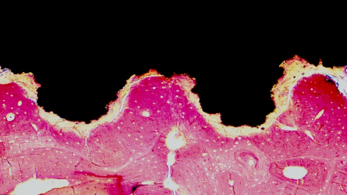 Işık mikroskobu altında implant yüzeyi ile canlı kemik dokusu arasında