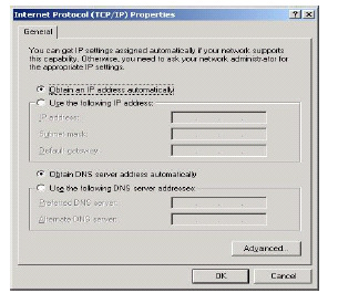 2. Adım TCP/IP -> Conexant USB Cable Modem üzerine tıklayınız. 3.
