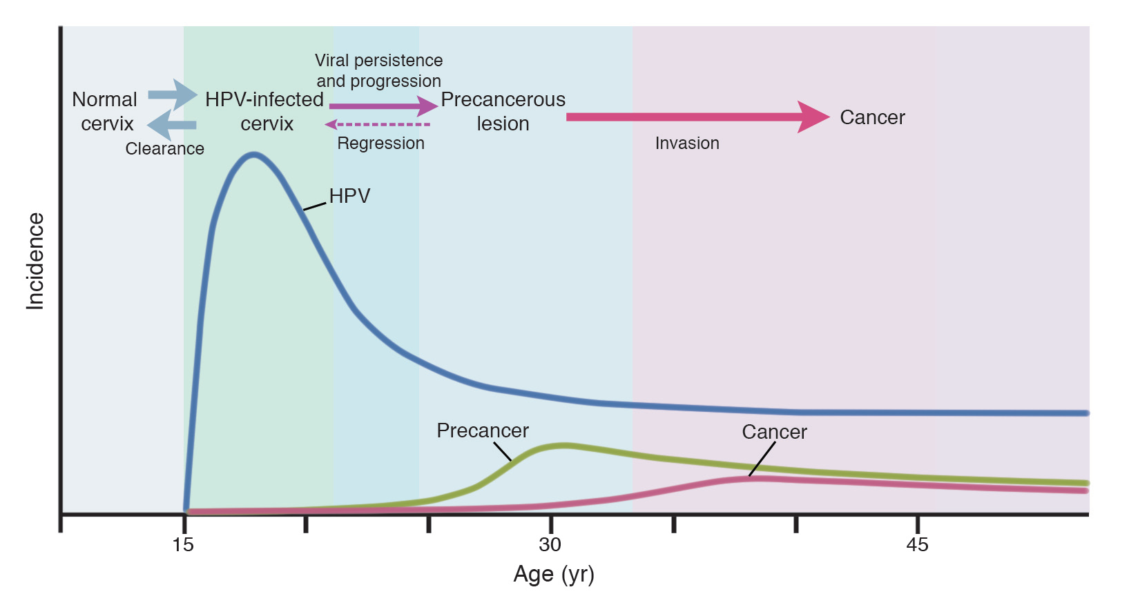 İnsidans HPV İnfeksiyonunun Seyri- Servikal Kanserin Zamansal İlişkisi Normal Serviks Klirens HPV ile infekte serviks Viral persistans ve ilerleme Gerileme Prekanseröz Lezyon İnvazyon Kanser