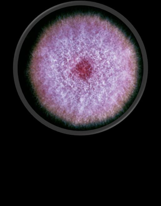 Risk faktörleri KİT GvHD SOT Lenfopeni Hematolojik malignite Yanık Nötropeni