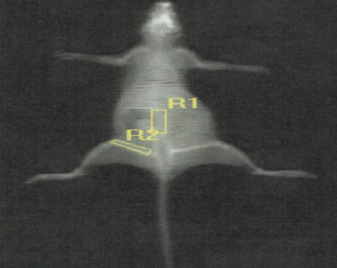 Şekil 1. KMY ölçümü için lomber bölge (R1) ve sağ femurd iafizine konulmuş (R2) ilgi alanları. Şekil 2: Gruplar arası omuz kalça mesafesi, femur ve tibia boy uzunluk grafiği.