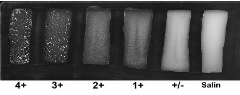 Şekil 7. Süzgeç kağıdında oksidaz pozitif ve negatif sonuçların görünümü (1). Tablo 3. Neisseria ve Moraxella türlerinin Ģekerleri kullanması (1,20,31).
