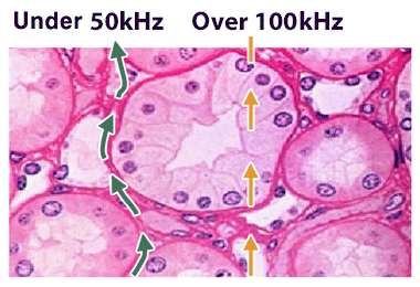 FREKANS Vücuttan geçirilen elektrik akımı düşük frekanslı(50 khz) ise hücreler
