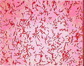 V.cholerae Gram negatif Virgül şeklinde Hareketli Aerop Alkali ortamda üreyebilen