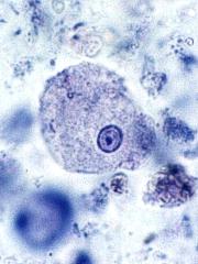 Entamoeba histolytica