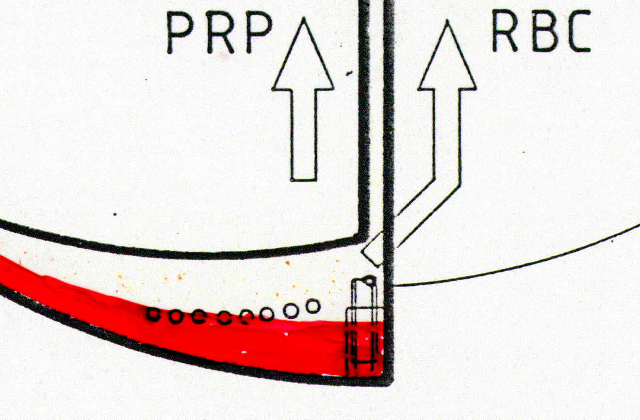 Odacık sisteminde ayrış ıştırma Interfaz odacık Plazma