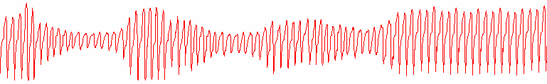 HAVA AKIMI BASINÇ DESTEĞĠ Apne ve Hipopne sırasında uygun ventilasyonu sağlamak için basınç desteği vermek Hiperventilasyon ve normal solunum sırasında