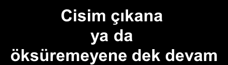 Yabancı cisim obstrüksiyonu Ciddiyeti değerlendir Ciddi tıkanma ÖKSÜREMEZ Orta tıkanma ÖKSÜREBİLİR