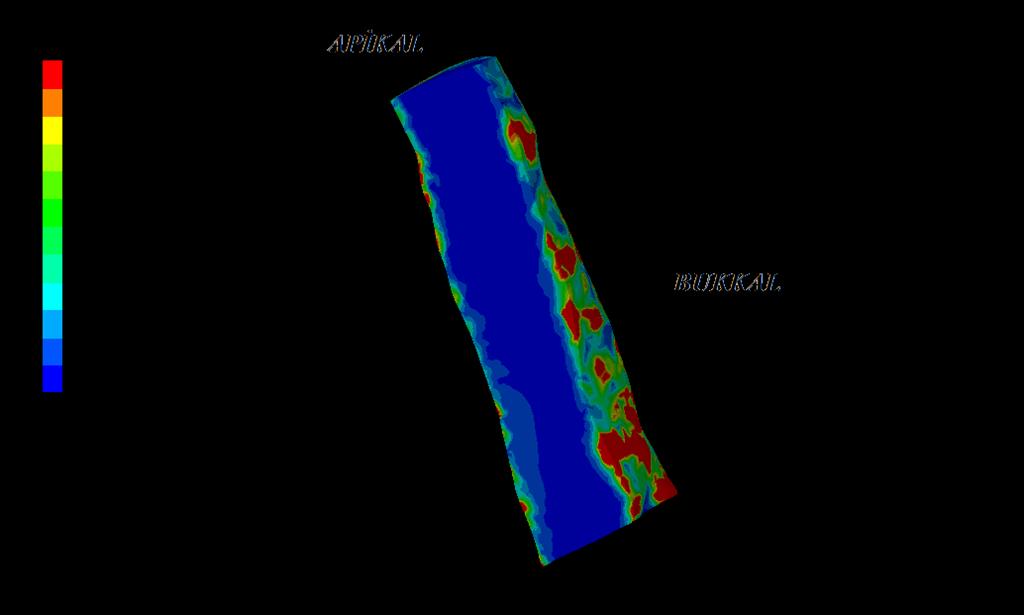 Resim 3.4.9. Tech Biosealer modeline ait von Mises stres dağılımı (MPa). Kırmızıdan maviye doğru renkler azalan stres değerlerini belirtmektedir. Resim 3.4.10.