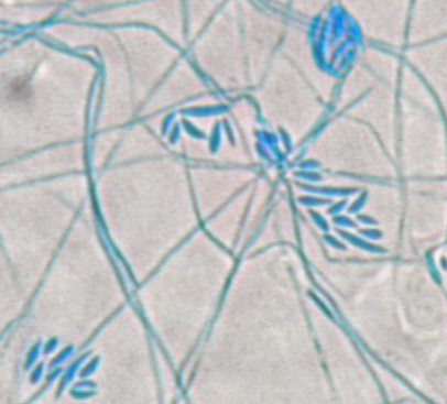 Şekil 11. Alternaria sp mikroskobik görünümü (Olympus CX31; ~150x) Şekil 12.