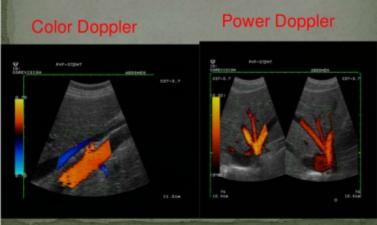 Renk gri skala görüntü üzerinde görülür 3D, 4D USG Gri skala görüntüleme A-mod B-mod M-mod Doppler görüntüleme Power Doppler Color Doppler Puls Doppler Duplex Doppler En basit yöntem Puls-eko