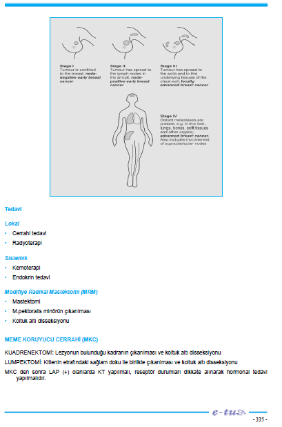 96. Meme tümörü nedeni ile yapılan modifiye radikal mastektomi materyali aşağıdaki anatomik yapılardan hangisini içermez?