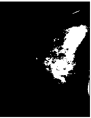 Hesaplanan eşik değerinin üzerindeki pikseller beyaz, alındaki değerler siyah yapılarak görüntü siyah beyaz hale getirilir ve bölütleme gerçekleştirilmiş olur. 2.2.3.