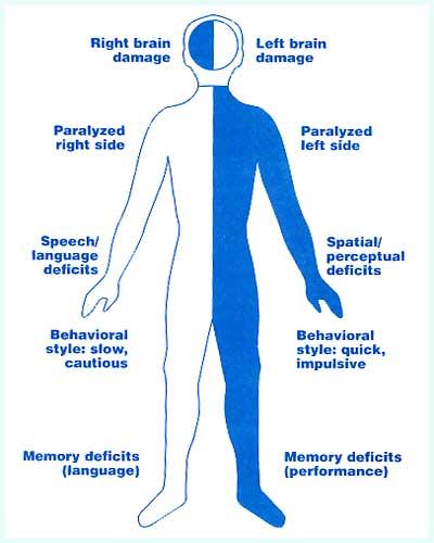 BULGULAR Fokal güçsüzlük (en sık izlenen bulgu) / Duyusal kayıplar /Konuşma bozuklukları / Görme kayıpları ICF Psikolojik/fizyol/anatomik yapı veya fnk kaybı: Impairment