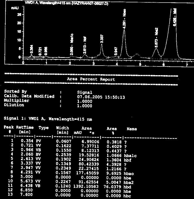 Şekil 4.26: Hb S belirlenen olgunun HPLC görüntüsü.