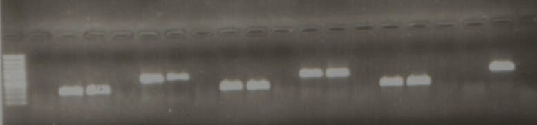 EK-3: Debaryomyces hansenii İÇİN 5.8S rrna ve 26S rrna ANALİZLERİ PCR Optimizasyonu : 50 o C 55 o C 60 o C F1R1 F2R2 F1R1 F2R2 F1R1 F2R2 1 1.5 2 1 1.