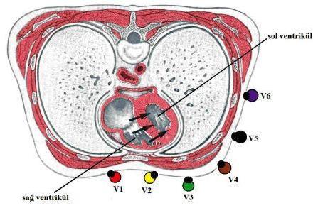 21 DİKKAT!!! Şekil 21. Göğüs Derivasyonlarında Elektrotların Yerleşim yeri Elektrotların tam olarak interkostal aralığa yerleşimine dikkat edilmelidir.