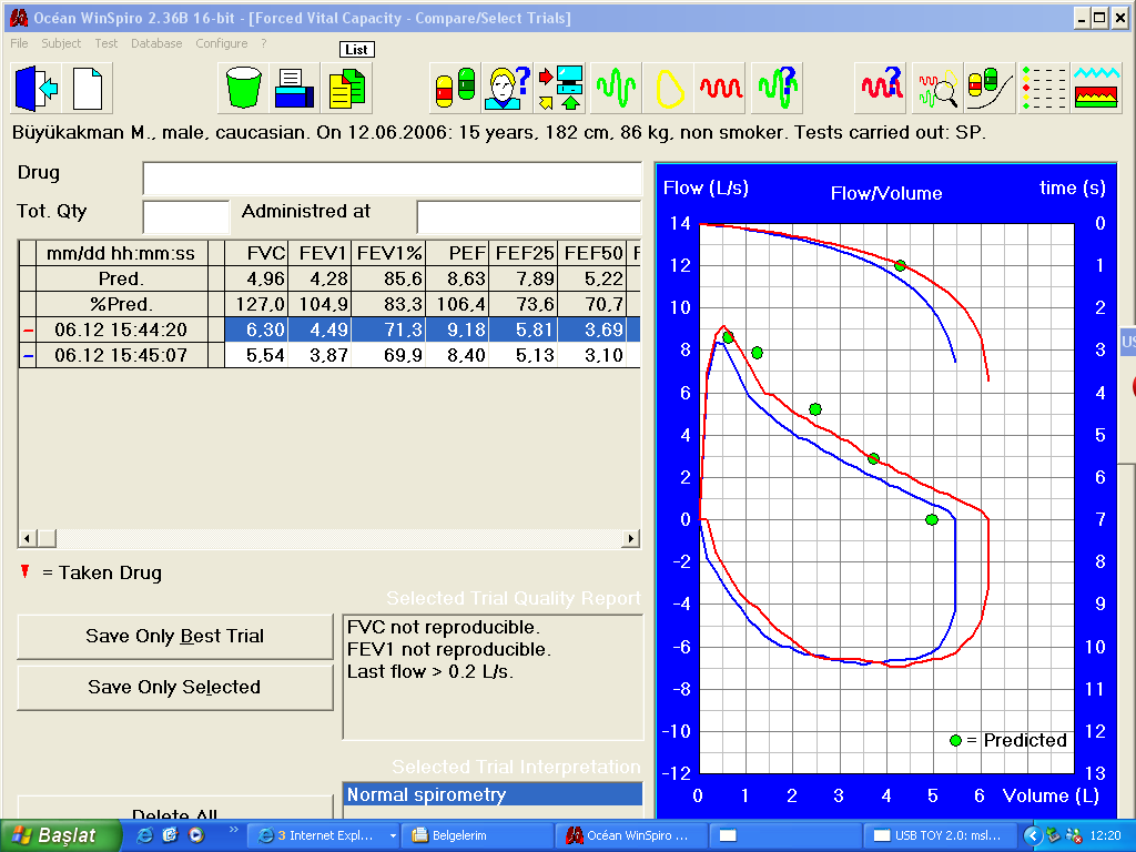 FVC %127, FEV1