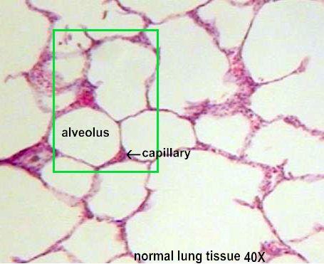 Difüzyon Alveol yüzey sıvısı, Alveolar