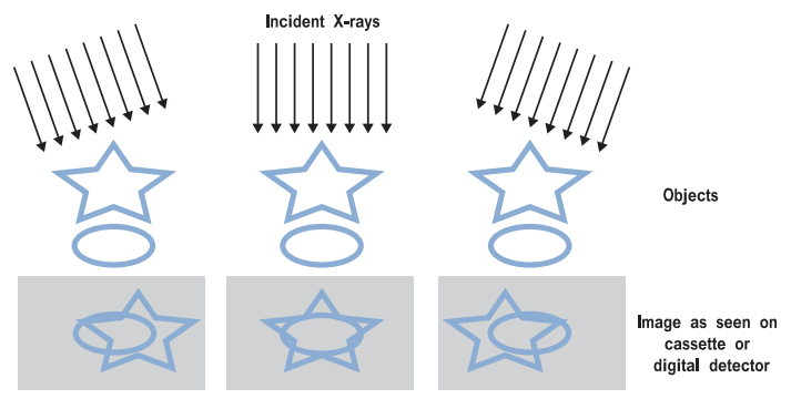 resolution images whose planes are parallel to the breast support in spite of at a lower dose, and if desired, these can be viewed as well. Figure 1.