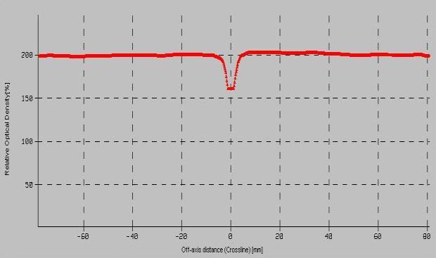 A B Şekil 30. İki izomerkezli ışın diverjansına uygun masa ve gantri açılı teknikte oluşan sagital kesitteki A-izodoz eğrileri B-doz profili (-1mm aralık hat için).