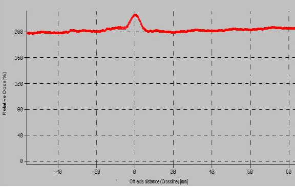 oluşan sagital kesitteki A-izodoz eğrileri B-doz profili (+1mm çakışan hat için) A B