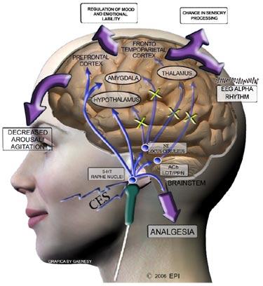 Beyin Akımları CES engages the serotonergic (5-HT) raphe nuclei of the brainstem. 5-HT inhibits brainstem cholinergic (ACh) And noradrenergic (NE) systems that project supratentorially.